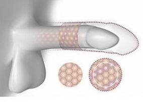 Penis crescut în volum