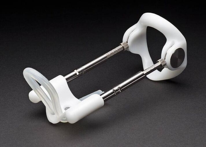 extender după operația de mărire a penisului